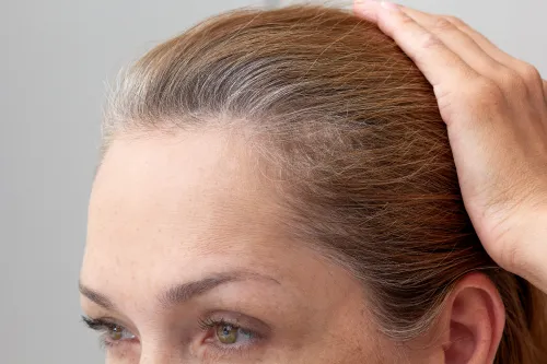 Hairloss First Choice Family Medicine